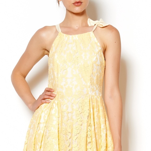 Coconinno Wonder Dress - Lace Yellow - Picture 6 of 11